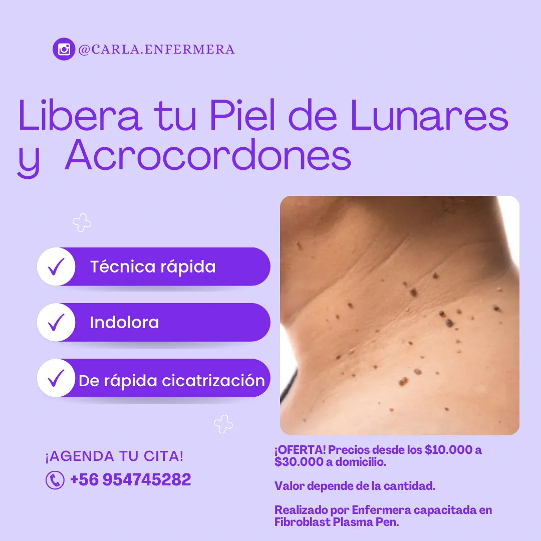Fibroblast Plasma Pen